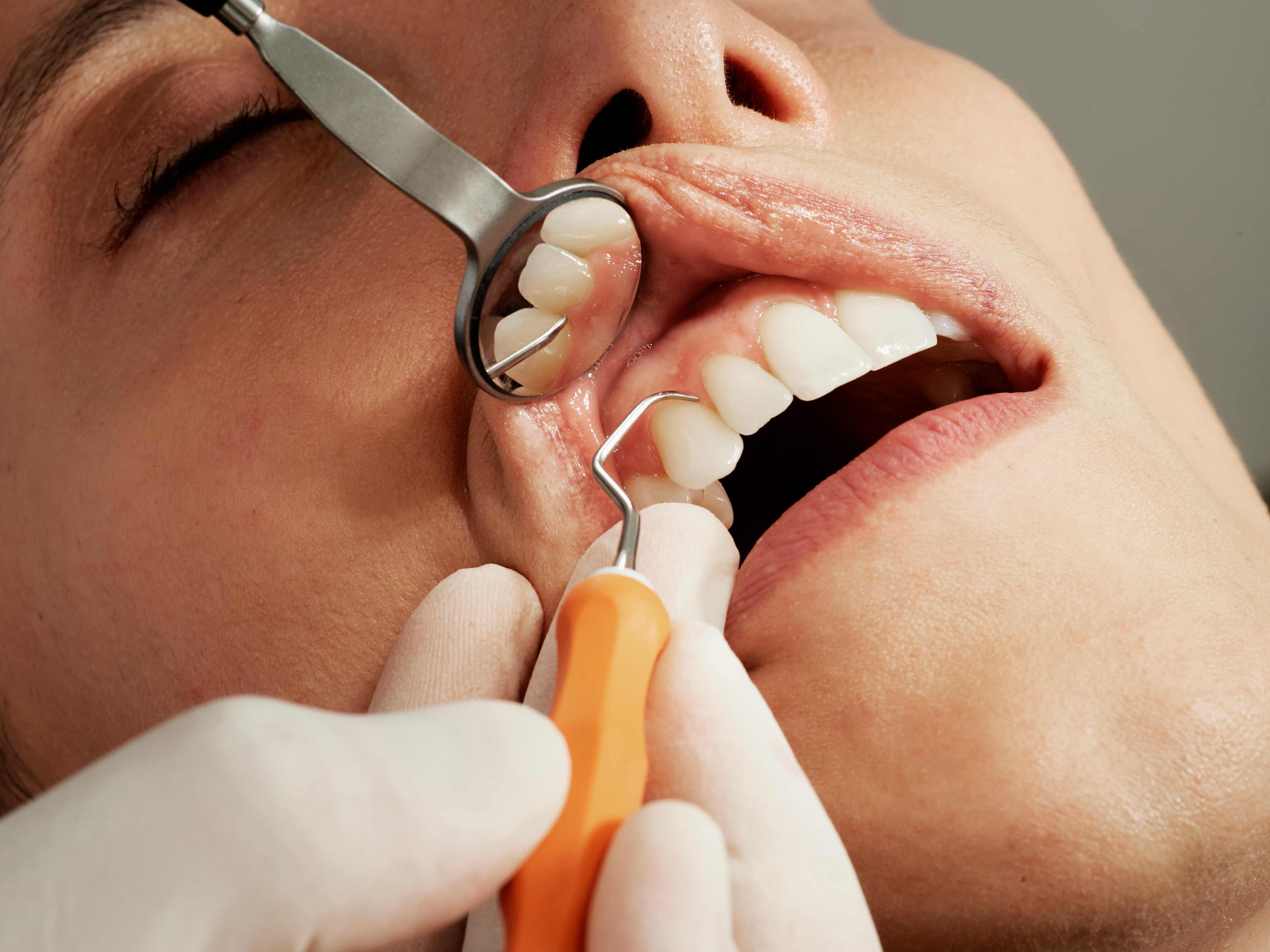 Dental Health
